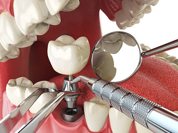 Best Emergency Treatment for Toothache in Nashville, NC