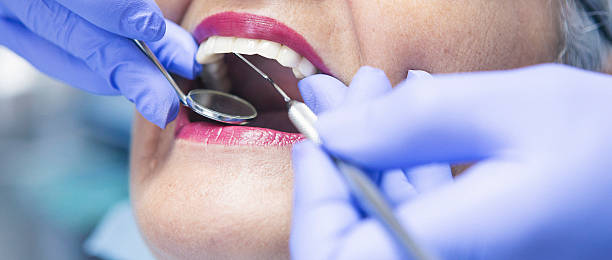 Best Emergency Wisdom Teeth Removal in Nashville, NC